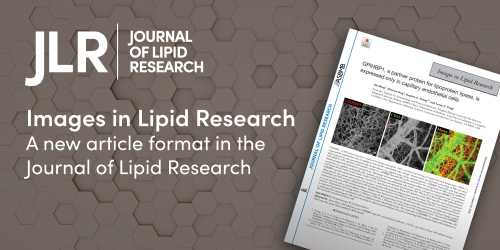 ASBMB (@asbmb) on Twitter photo Have you heard about <a href="/jlipidres/">Journal of Lipid Research</a>' new article format, "Images in #Lipid Research?" Each peer-reviewed, one-page article contains a single horizontal image, a 400-word caption and up to four references. Learn more: jlr.org/content/early/…. Have you heard about <a href="/jlipidres/">Journal of Lipid Research</a>' new article format, "Images in #Lipid Research?" Each peer-reviewed, one-page article contains a single horizontal image, a 400-word caption and up to four references. Learn more: jlr.org/content/early/….