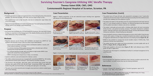 WoundSource's tweet photo. Check out this poster on surviving Fournier’s gangrene by utilizing VAC veraflo therapy. #woundcare #woundsource #posterhall https://t.co/gnJQ0NBiv0 https://t.co/XlDQtD2ypt
