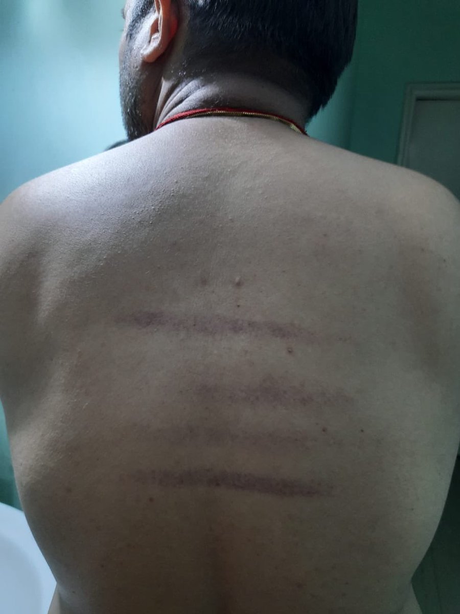 doctorravi21's tweet photo. @PMOIndia @JharkhandCMO @DCDeoghar @BannaGupta76 attack on doctor is so easy now a days. How and why we should risk our life in this pandemic situation? Will not serve these morons . @sadar hospital deoghar https://t.co/PfKeoO5auj