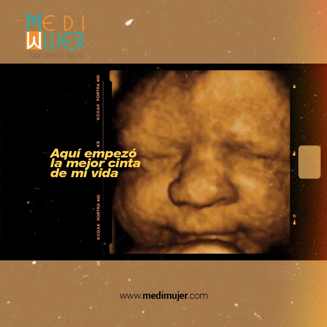 MediMujer3D's tweet photo. ECOGRAFÍA 3D 4D para que veas a tu bebé antes de nacer, SEPARA TU CITA https://t.co/SqakcRrUN9 (574) 235 4280 WHATSAPP 300 617 9295 info@MediMujer.com

#embarazo #ecografía3d4d #ultrasonido #eco3d #baby #3d4d #ecografía #ecografíamedellín #medimujer #bebé #cirugiaplasticavaginal https://t.co/HoVhutjpyy