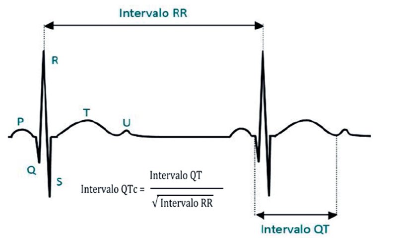 martinezcuevas_'s tweet photo. 2. Fórmula de Bazzet (más usada). Para aplicarla necesito usar milisegundos. ¿Cómo? 📏 Cuento cuadraditos=1mm entre intervalos y multiplico por 0,04
#MIR2021 #MIR2020 #expriMIR https://t.co/KE2LEXKJdd