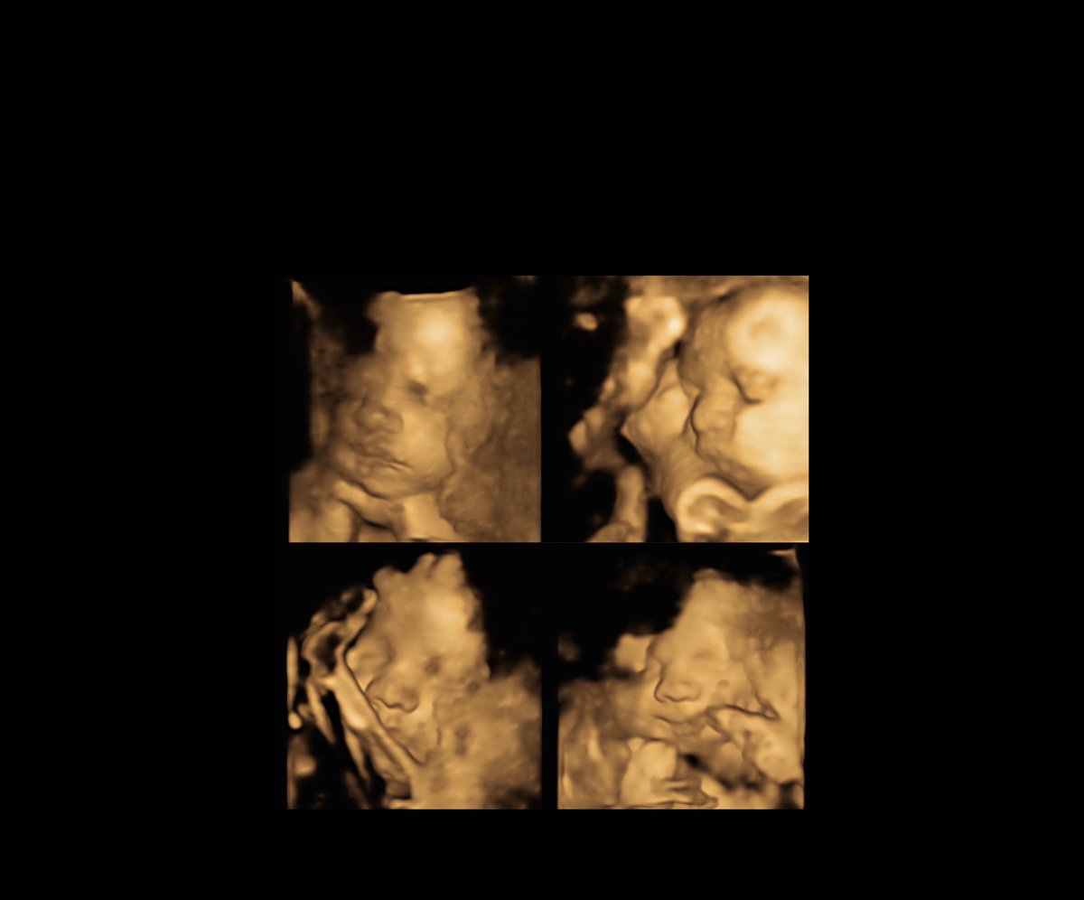 _ChelsJeri's tweet image. My little Tiger🐅 #JhettBurreaux💜💛 @Joe_Burrow10  #comingMay2020