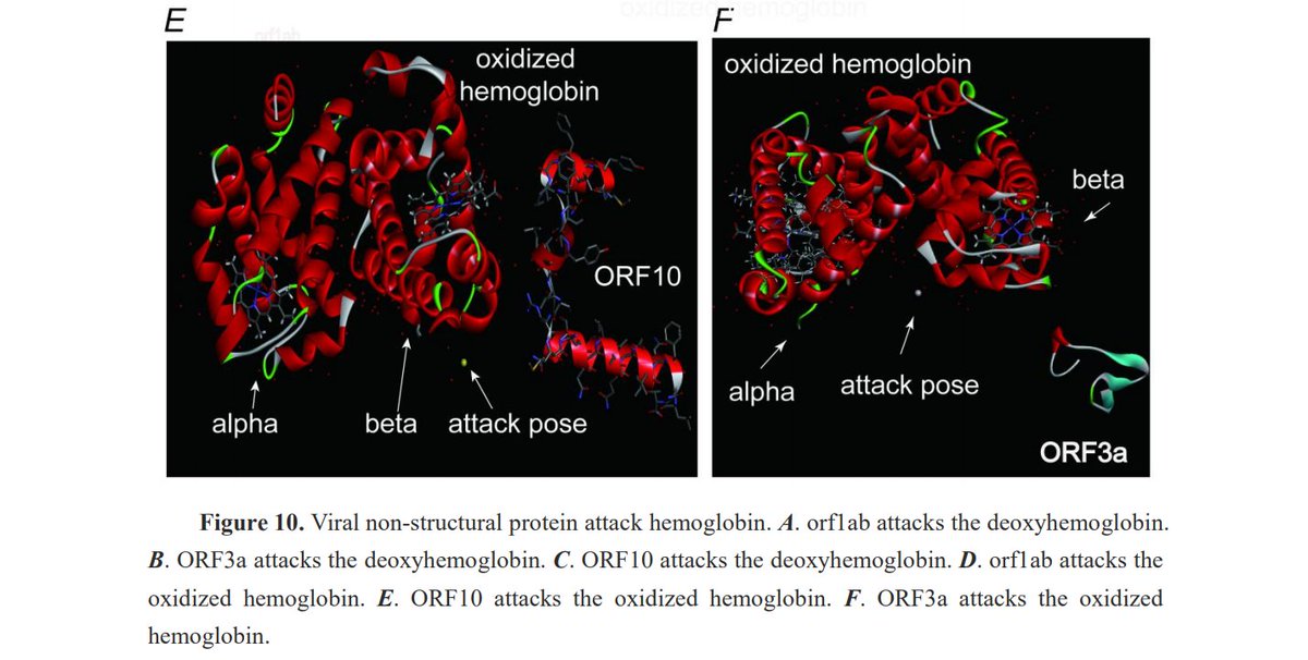 2019-SARS-nCoV virus attacks beta2 unit of hemoglobin in order to capture porphyrin, thereby making partially deoxyHemoglobin, causing less oxygen affinity, & releasing iron. Is this related to profound hypoxia seen in some patients?  #COVID19 (Photo from:  http://tiny.cc/eh62lz 