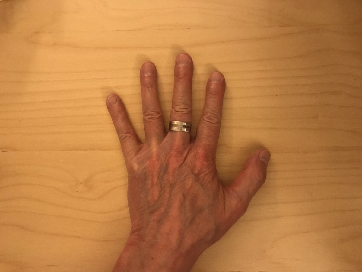 ZataShop_com's tweet photo. PART I...of XII

From the LinkedIn account of 
CJ Esse, Founder of ZataShop.

#COVID19 is overwhelming spread by touching your hands to your face after your hands have been in contact with the virus.  

Up to 99% of the infections are caused by this according to Dr. David Price. https://t.co/HBE0cGhPIf
