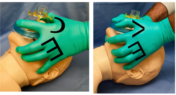 Anton Helman tweet media