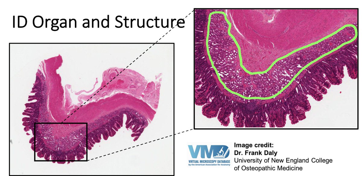 ID organ and the highlighted structure in the zoomed box.
What is the function of this organ, embryonic origin, and vascular supply? #Educators and #researchers Join virtualmicroscopydatabase.org! #histology #embryology #anatomy for more virtual slides at VMD! 
#staysafeandhealthy
