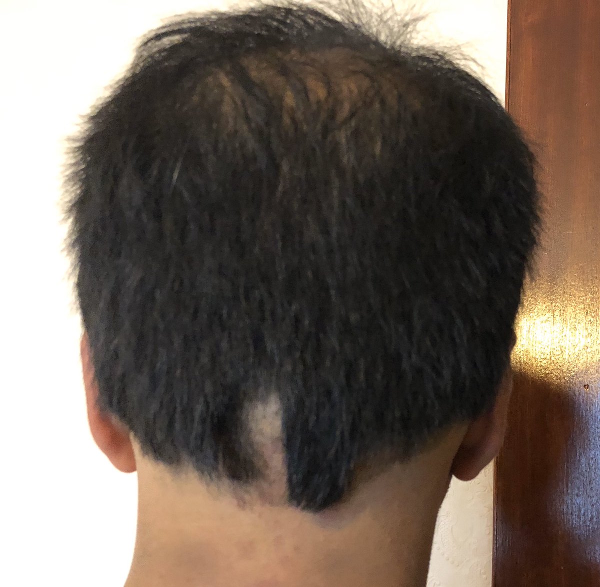 sahask76's tweet photo. Lesson learnt-just leave the ratβs tail π³#coronacuts #scarecut Can a scarf be classed as PPE? π€¦πΎββοΈ https://t.co/RM5ZNFX554