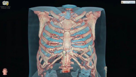 DocOnTech's tweet photo. 3D image shows the serious effects of COVID-19 on lungs #ShareYourWeather https://t.co/1PHtBXlxCG https://t.co/w9pVw2lI9n