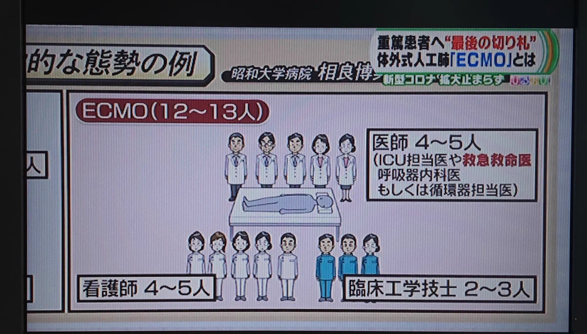 重篤患者に対する最終手段「ECMO」に必要な人の数が多すぎる！？