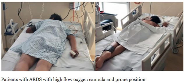 18/ Our experience in COVID patients has been similar. While still in the early stages of data collection, prone positioning in patients not mechanically ventilated seems to improve oxygenation, tachypnea, and dyspnea.