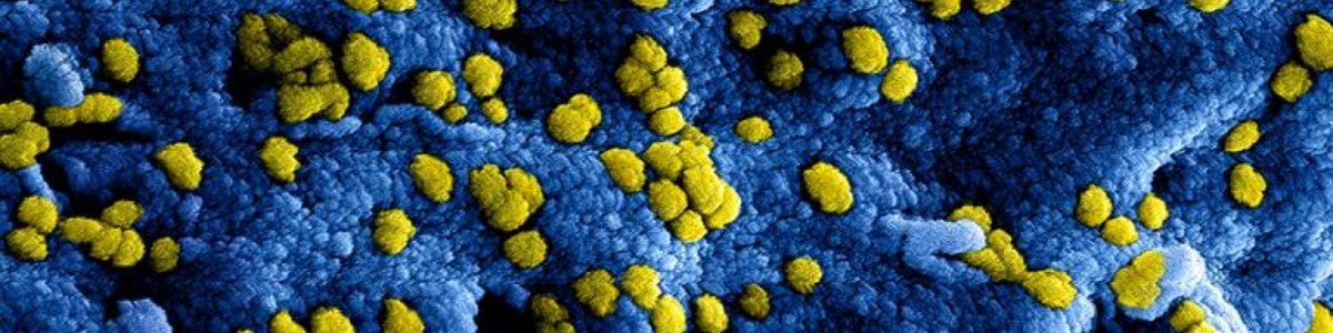UOVDeKring's tweet photo. Het Corona virus raakt ons hard. De maatregelen hebben verstrekkende gevolgen voor velen van ons. Op 2 april om 16.00 uur organiseren we een online vraaggesprek met experts om jou als ondernemer verder te helpen. Aanmelden: https://t.co/1pI8K6UZXE
Info: https://t.co/gFFS6ogxc5 https://t.co/KwHqX734Td