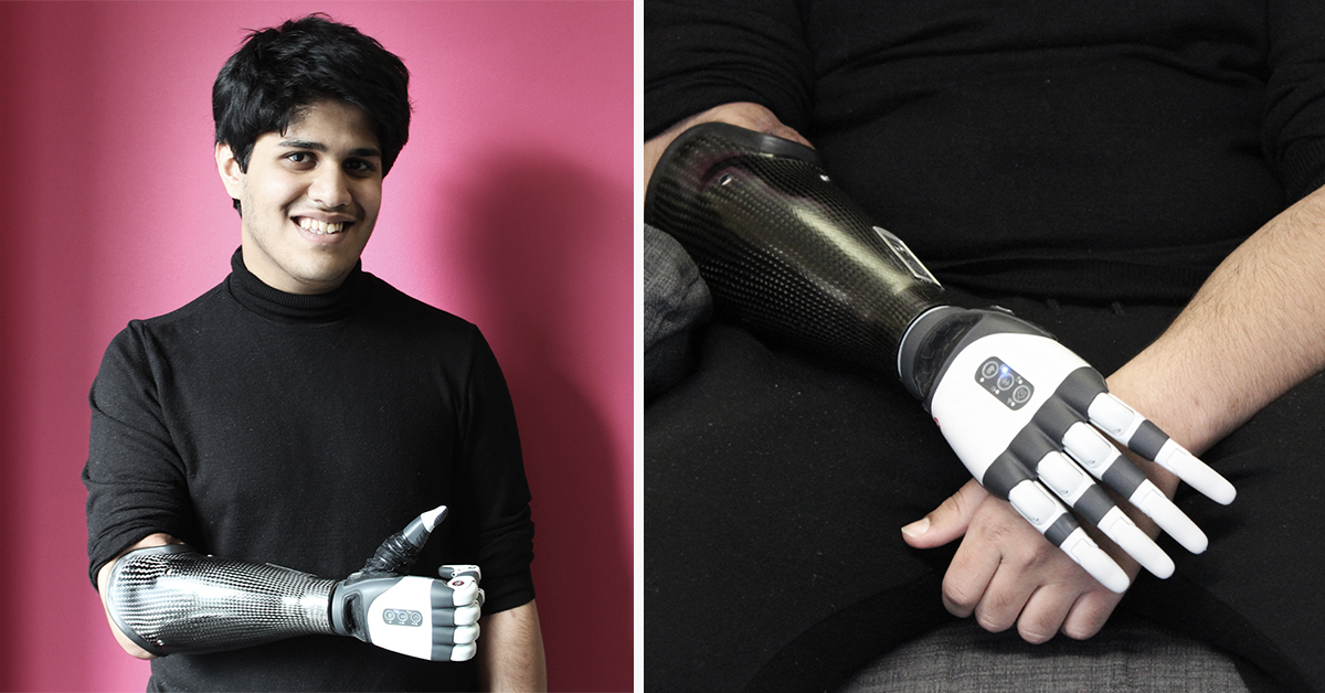 London Prosthetics (@lpcprosthetics) on Twitter photo We're pleased to announce that the team at The LPC have fitted the first multi-articulating TASKA Hand in the UK!
With a fully waterproof rating and optimised durability - it's one of a kind 🙌
Read the full feature now! bit.ly/3dHrZ2m
<a href="/TaskaGlobal/">TASKA™ Prosthetics</a> #tech #prosthetics We're pleased to announce that the team at The LPC have fitted the first multi-articulating TASKA Hand in the UK!
With a fully waterproof rating and optimised durability - it's one of a kind 🙌
Read the full feature now! bit.ly/3dHrZ2m
<a href="/TaskaGlobal/">TASKA™ Prosthetics</a> #tech #prosthetics