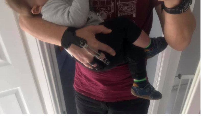 PaceRehab's tweet photo. "Simple but important", our patient's sentiment who is holding his child. Getting used to his new prosthesis @NPDevices  #PaceRehab #Prosthetic https://t.co/YPVCJ3w3kp