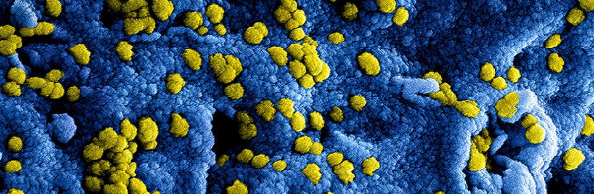 De Scania Zwolse Halve Marathon gaat zaterdag 13 juni 2020, vanwege het coronavirus, niet door. “Met pijn in het hart hebben wij als bestuur dit besluit moeten nemen”, vertelt voorzitter Teun Bouwhuis. #zhm20 #hardlopen #Zwolle 👉bit.ly/3ayrmq4