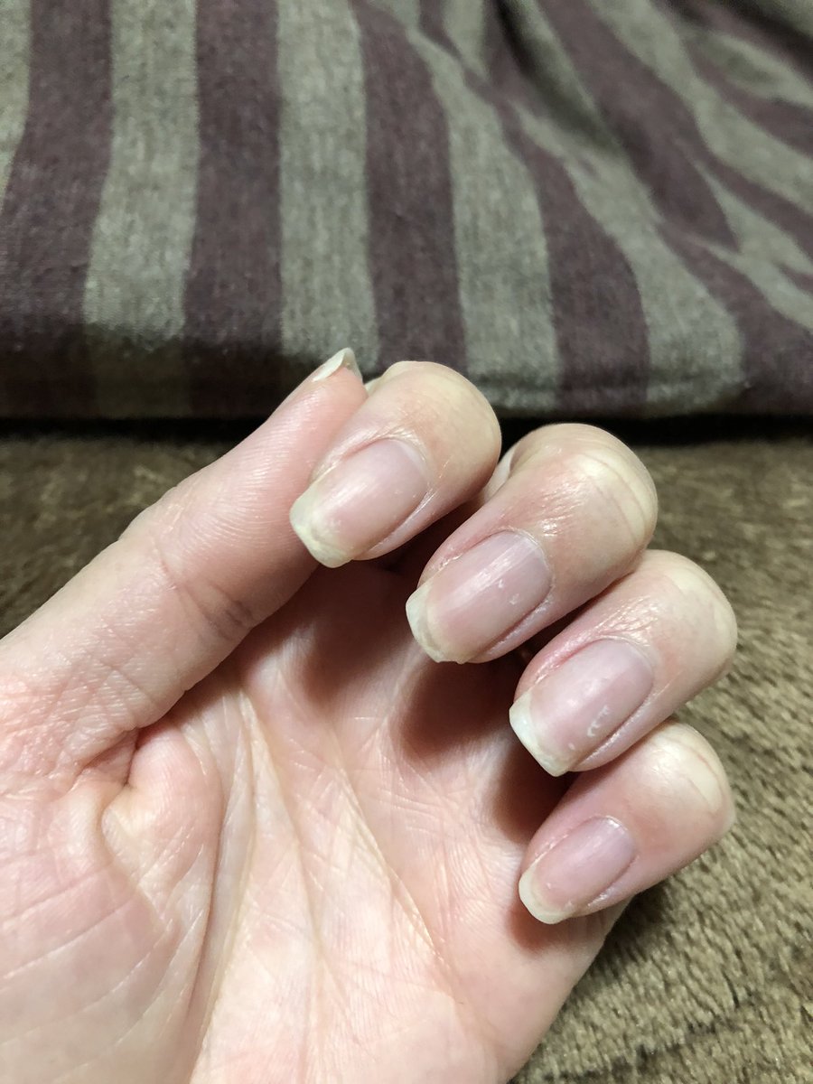 ワンたま え 中指いつの間にか爪欠けてるんだけどなに る