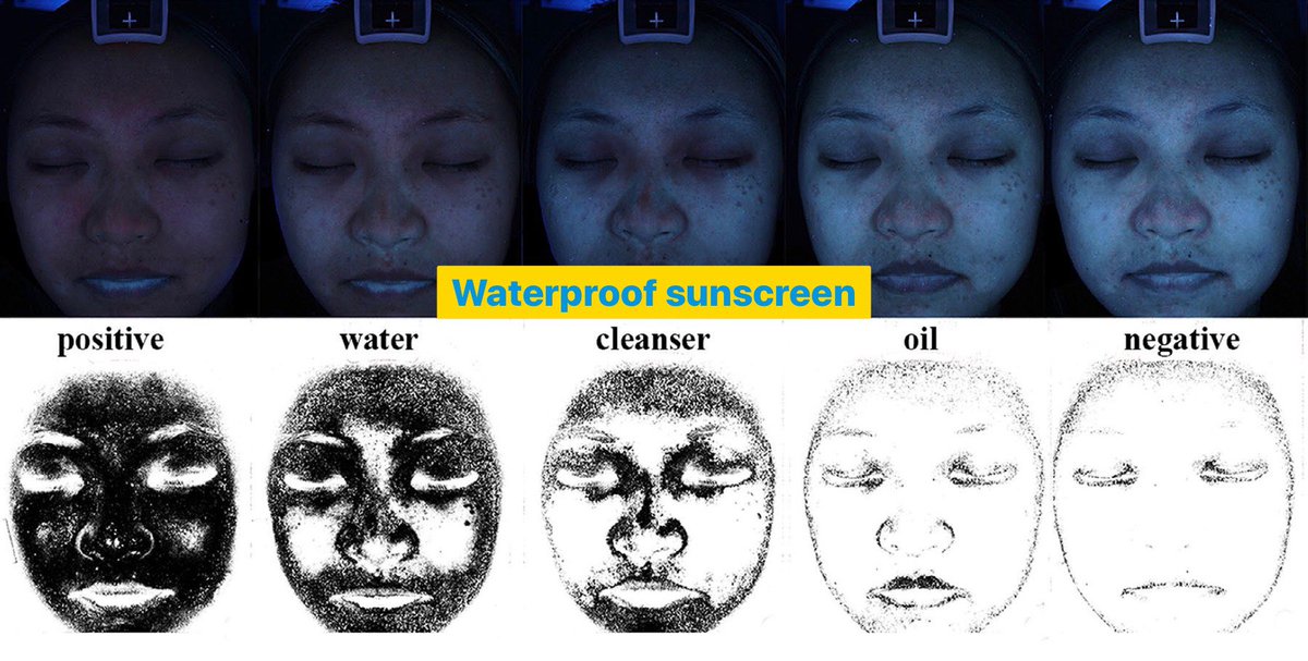 kenglimm's tweet photo. (4) สรุป แนะนำล้างหน้าด้วย

คนที่ใช้กันแดดปกติ (non‐waterproof): cleanser หรือ cleansing oil 

ส่วนคนที่ใช้แบบกันน้ำ (waterproof): cleansing oil

**วิจัยนี้ให้อาสาสมัครทาแค่ทากันแดดอย่างเดียว ไม่ได้ทาเครื่องสำอางอื่นนะครับ

#กันแดด #โฟมล้างหน้า https://t.co/RnPe0UaEbf