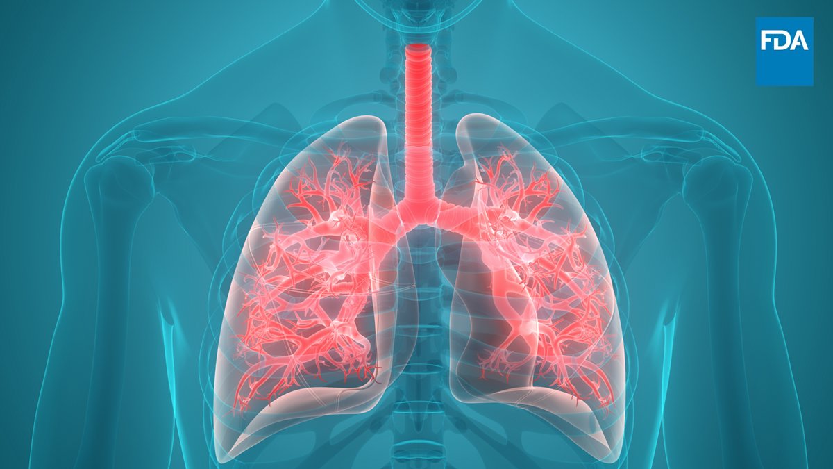 FDA Drug Information on X: #FDAapproves treatment for adult patients with  extensive-stage small cell lung cancer (ES-SCLC): t.co3fYjKQB9LO.  t.coqGrZUBPB7U  X