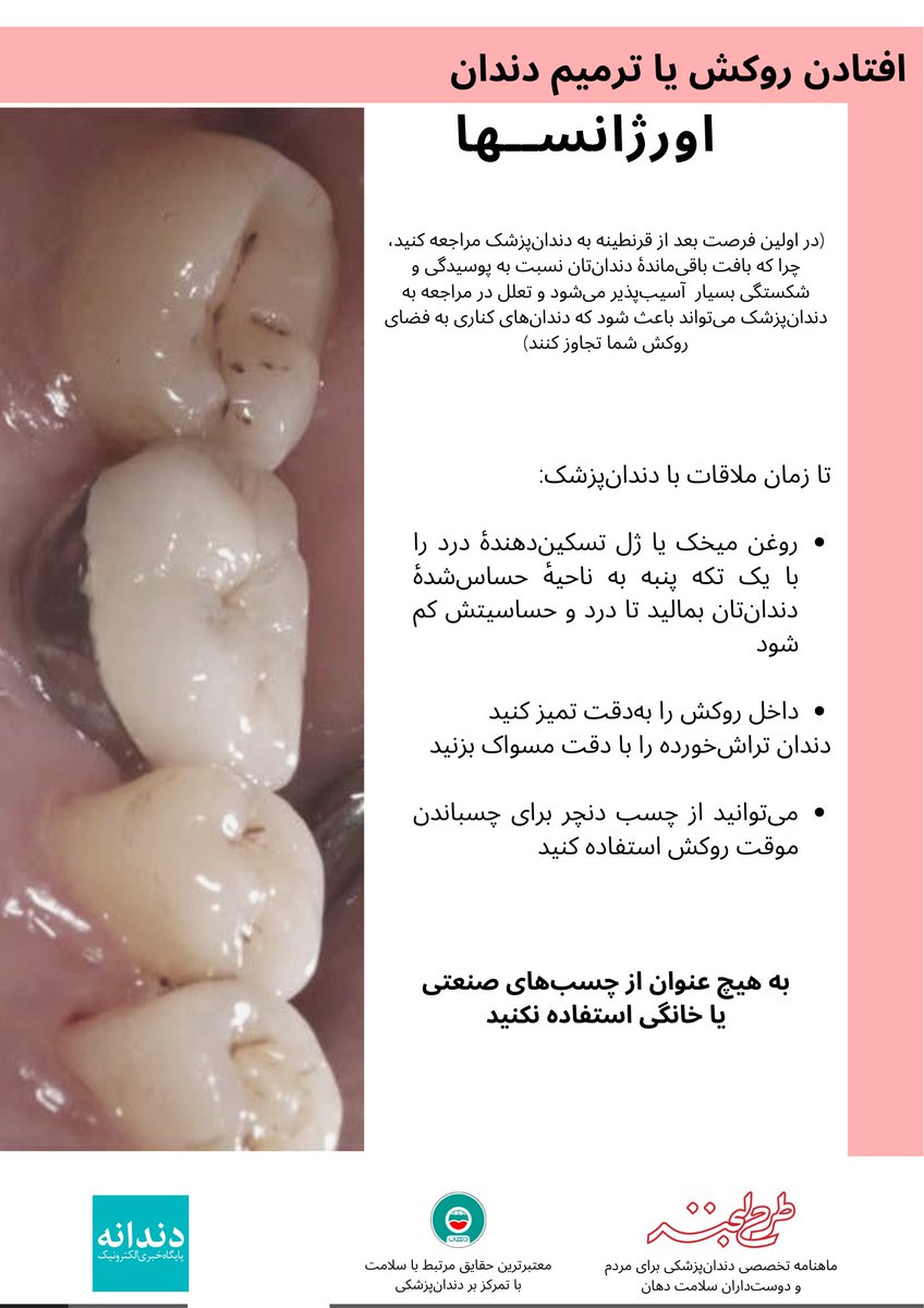 dahaan_ir's tweet photo. با همکاری @Maryam96sh، @pouria_i و @ASofiMahmudi 

و با حمایت نشریه طرح لبخند @TarheLabkhand و پایگاه خبری دندانه @dandane_ir https://t.co/VQXhgK3hiU