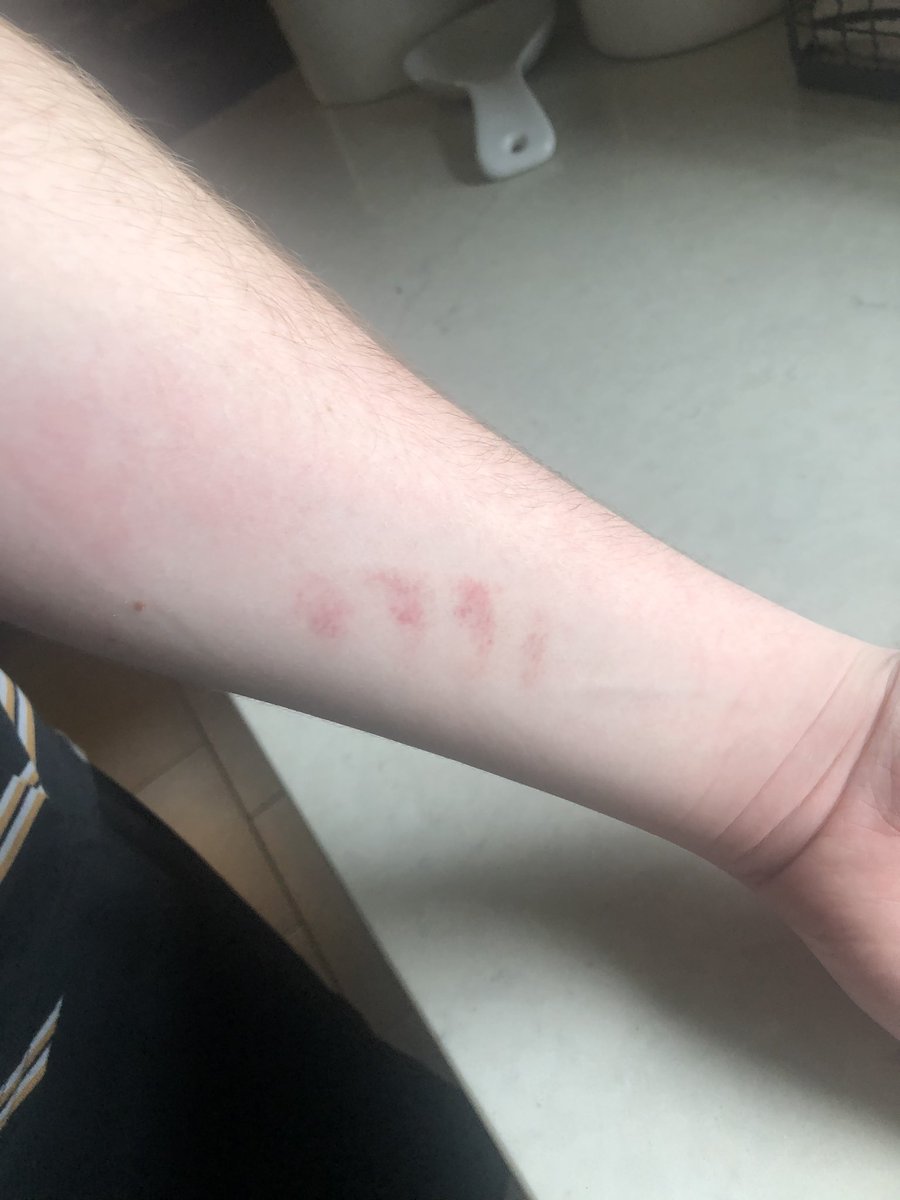 's tweet image. When your brother is a long snapper and you miss catching his snap. #perfectlaces