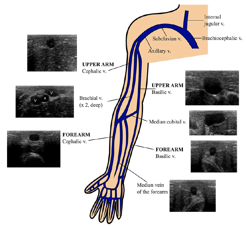 Resa E Lewiss MD tweet media