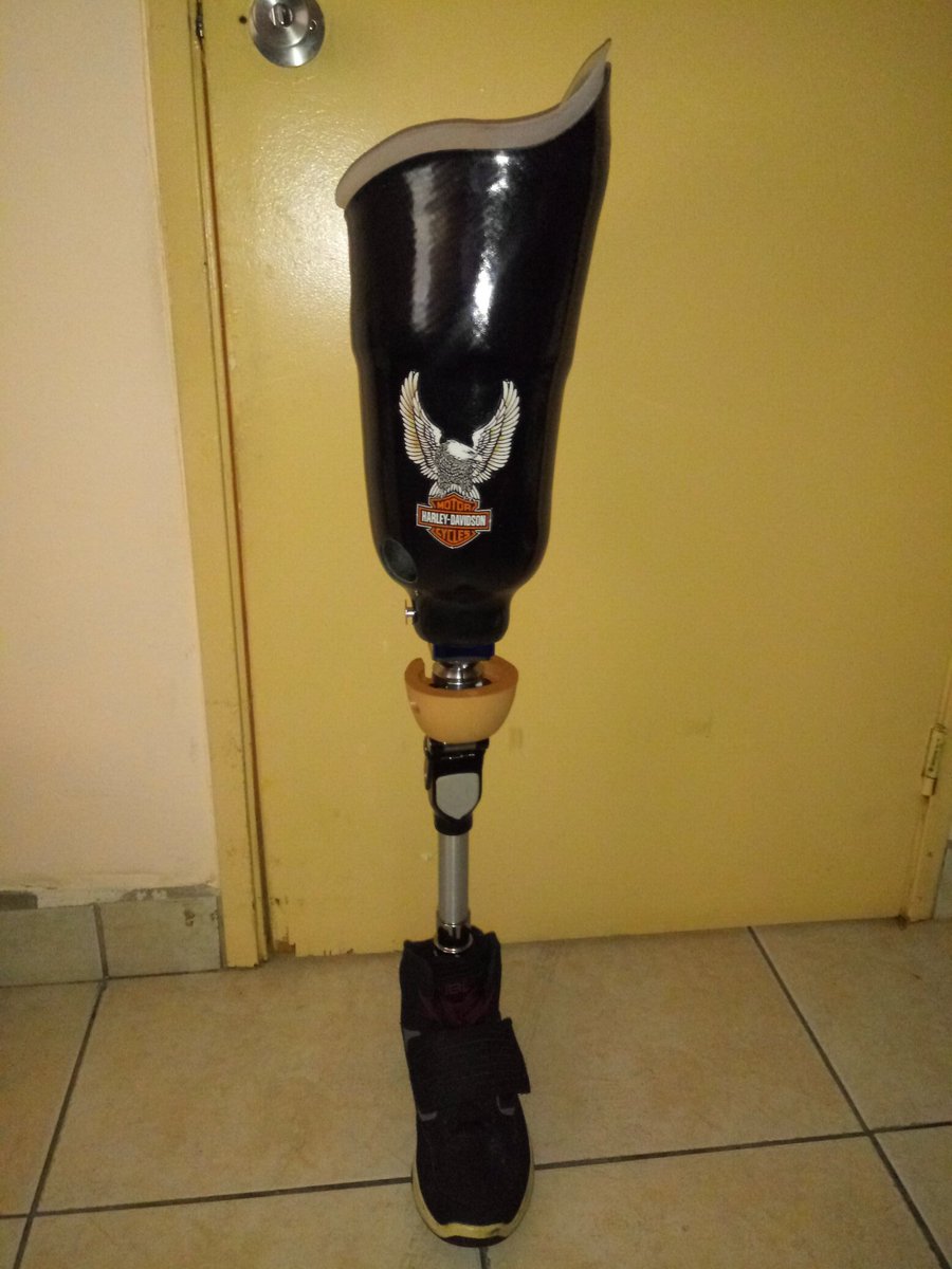 Boston3DXF's tweet photo. My New Leg !!! https://t.co/0pguwtbgJR