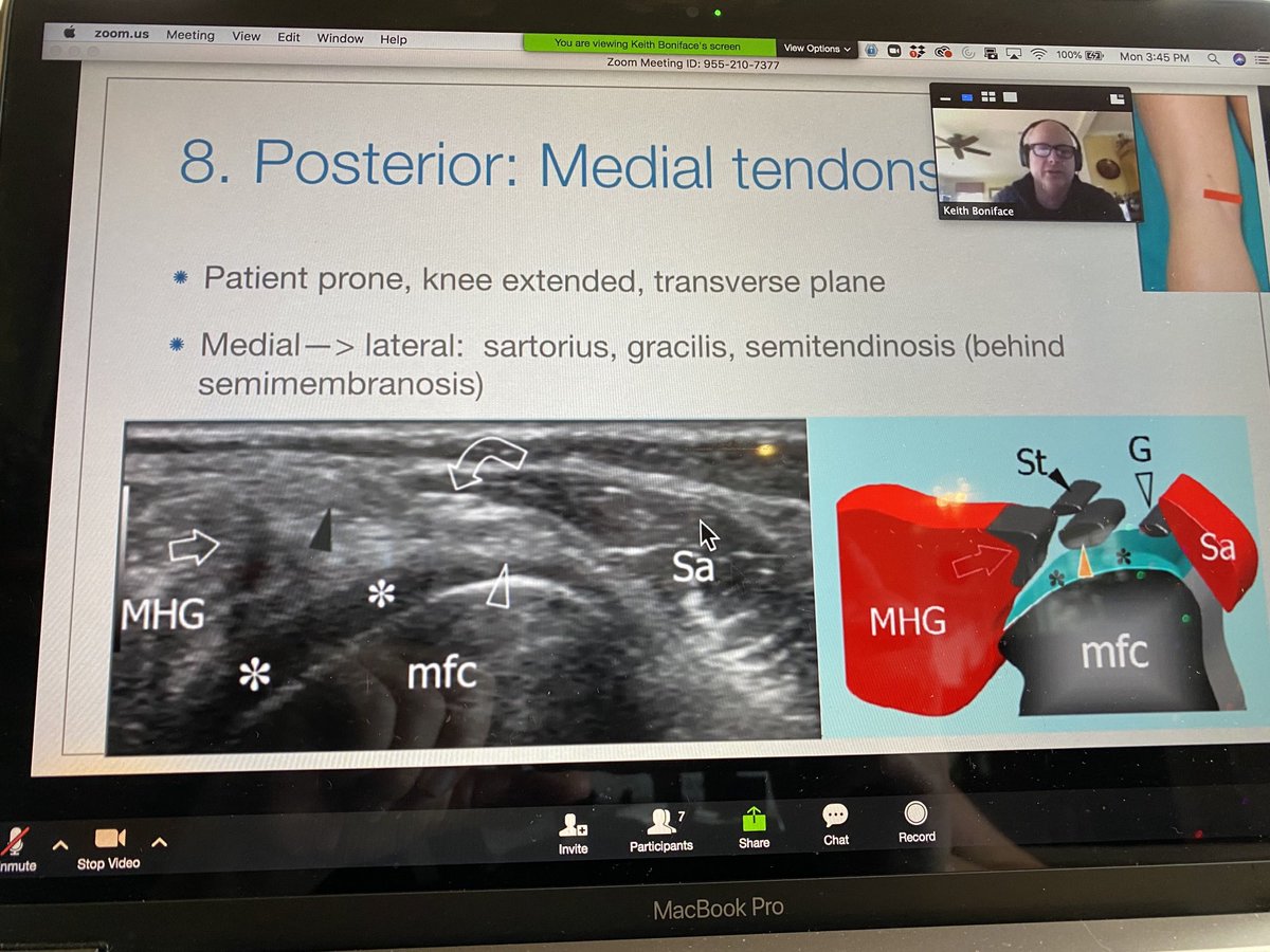 DrKittyKat's tweet photo. Virtual #POCUS education via #zoommeeting... #mskpocus knowledge 💣💣💣 dropped by the illustrious @BonifaceKeith @GWEMultrasound @ebethdearing @TenaciouZDoc @GWEMresidency https://t.co/pNS4QqI1Mn