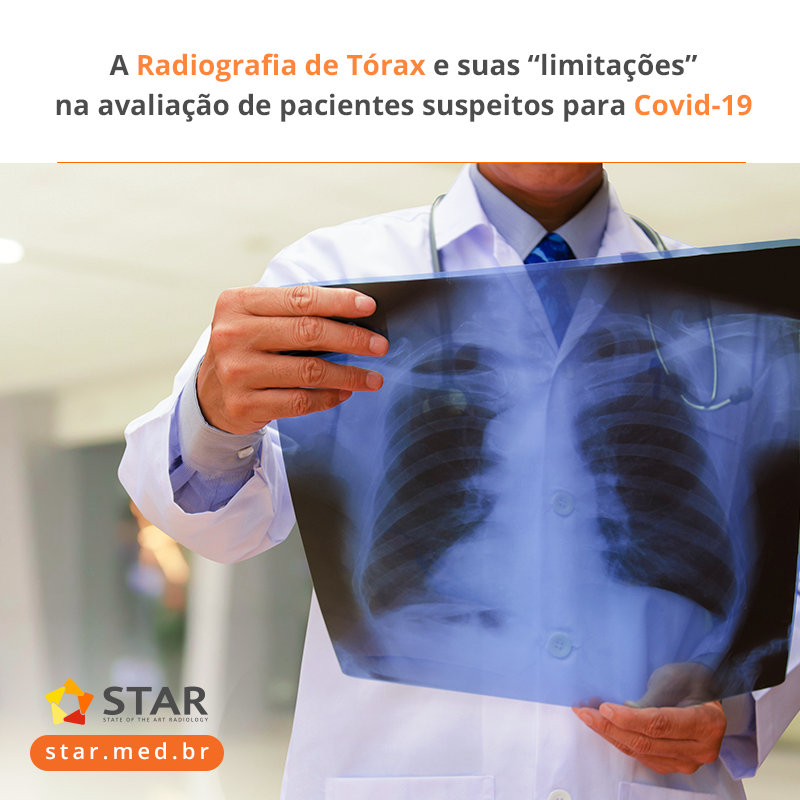 O uso da radiografia de tórax é rotineiro nos ambientes hospitalares, sobretudo no atual momento, que vivemos a pandemia do Covid-19. Analisamos, portanto, suas “limitações” na avaliação de casos suspeitos. Leia mais em nosso site. https://t.co/JSn7KJ2Faq