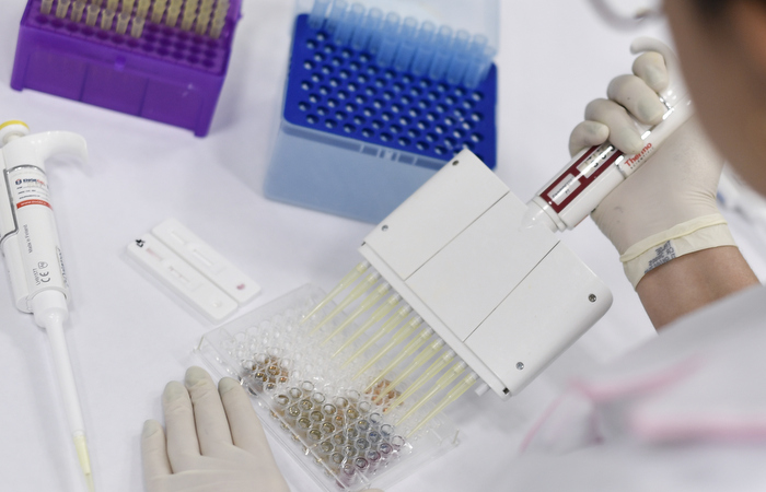 Casos de recuperação do coronavírus passam de 150 mil bit.ly/39uih0b