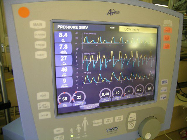 But for the Avea my hospital usesRed wave : Machine triggered breath Yellow: Patient triggered breath