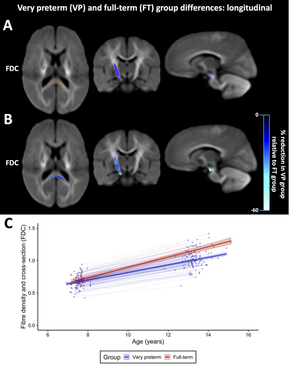 Latest pre-print led by @claireekelly_ - "Long-term development of white matter fiber density and morphology up to 13 years after preterm birth". A truly impressive effort characterising white matter development 13 years following pre-term birth. Link: tinyurl.com/t2tbxad