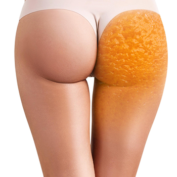 SPALosNogales's tweet photo. Se acerca el verano. Prepara tu cuerpo y olvídate de la celulitis este año. Lee en nuestro blog cómo puedes adecuar tu cuerpo para hacerte uno de nuestros tratamientos anticelulíticos. 
https://t.co/ejO0b8PWZ0

#LosNogales #SpaLosNogales #SpaenMadrid #Celulitis #Spa https://t.co/qz37mqnhch
