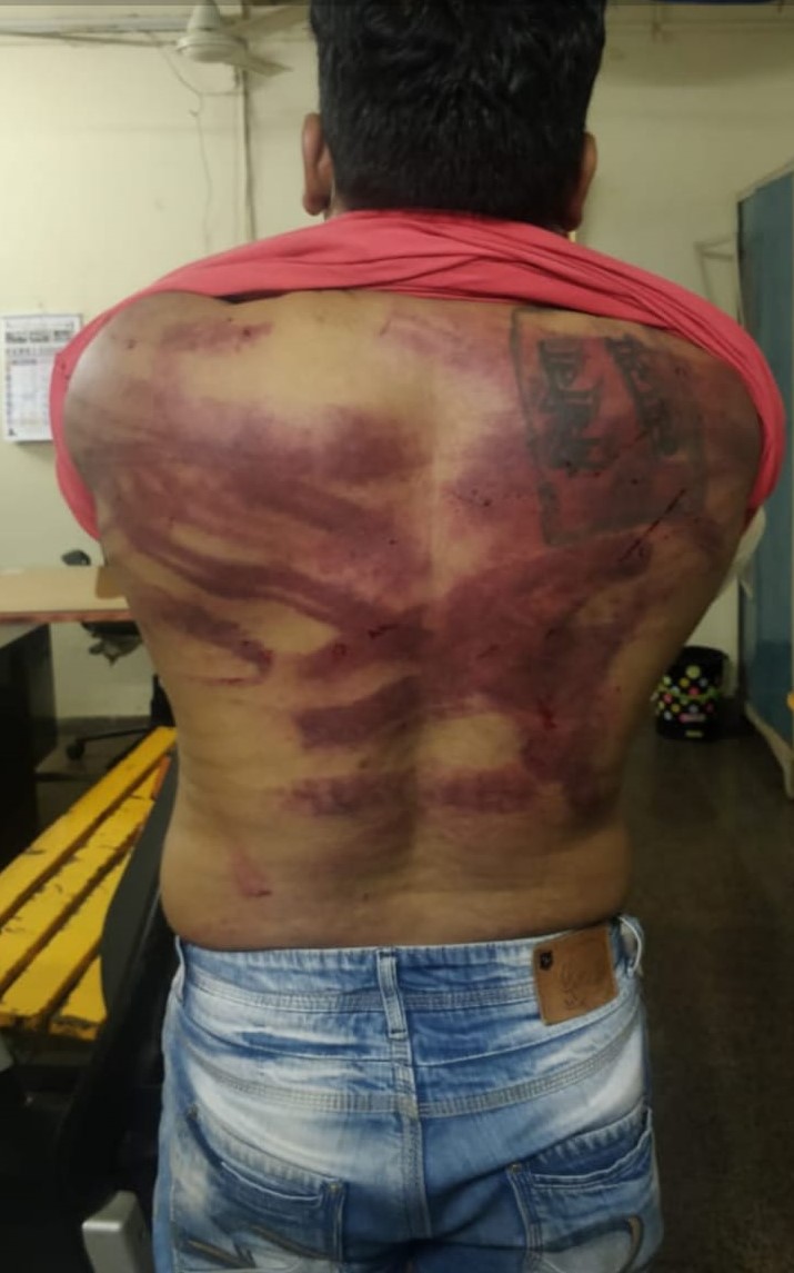 niranjandtweets's tweet photo. NCP goons of Min Jitendra Awhad abducted thane citizen for Tweeting different view with minister, was beaten in front of Awhad by 15 ppl, No action taken against such criminal behaviour. Is this democracy?@PMOIndia @AmitShah @Dev_Fadnavis @mipravindarekar @vinay1011 @OfficeofUT https://t.co/R78nR5xpkr
