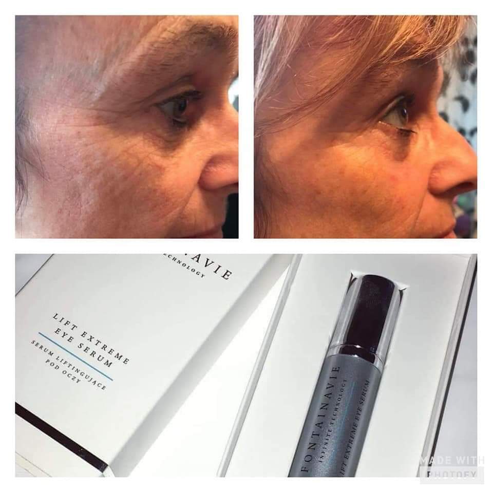 CSluijk's tweet image. 👉Last van kraaienpootjes of rimpels rond om de mond&amp;amp;Ogen?? Dat kan verleden tijd zijn met dit serum !
 
Interesse? 👇💌