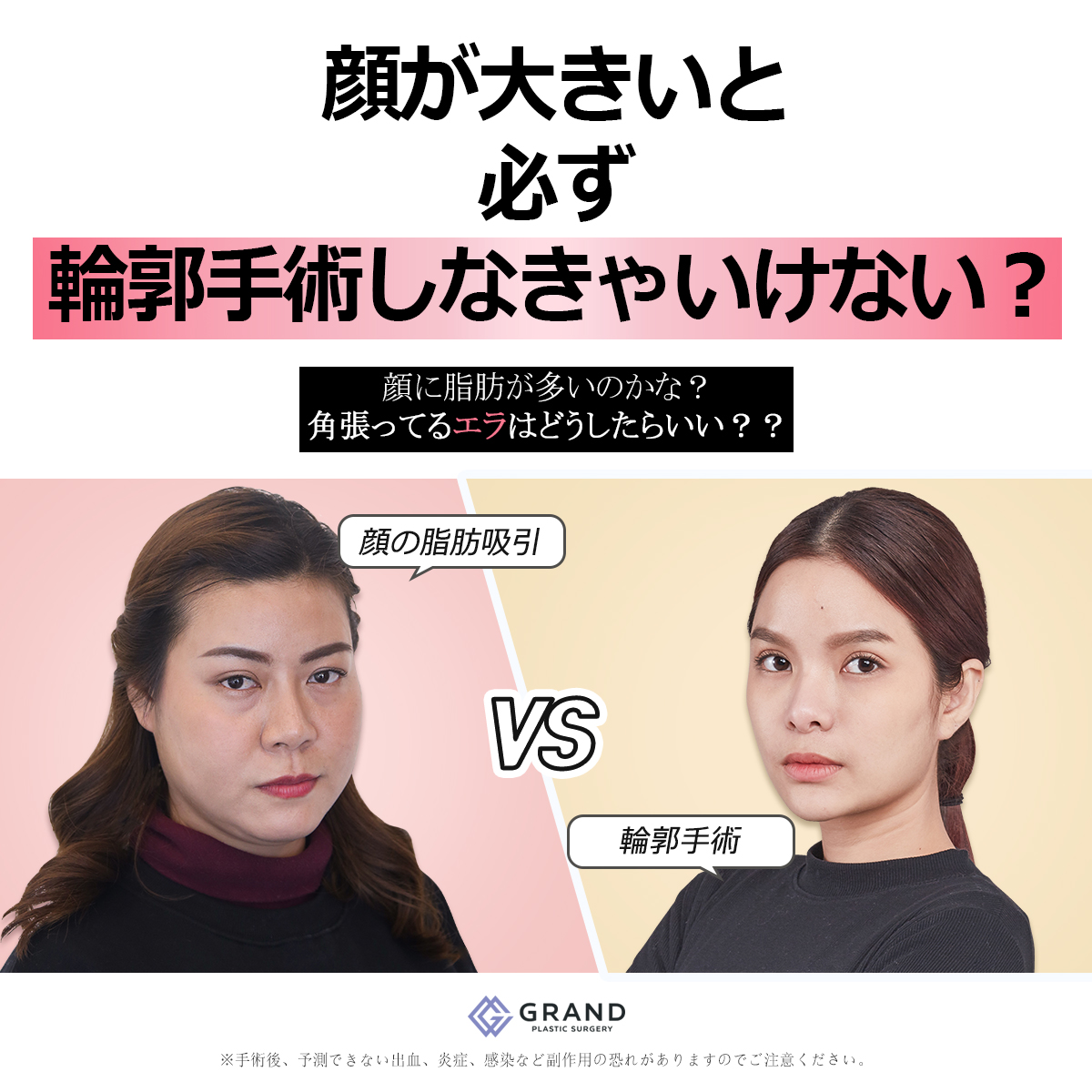グランド美容整形外科 顔が大きいと必ず輪郭手術しなきゃいけない 顔の脂肪吸引と輪郭手術で悩んでいる方は 是非参考にしてください グランド美容整形外科では 患者様の安全と美しさを最優先とする手術 各部位の専門執刀医が常駐 日本 グランド美容整形外科 顔が大きいと必ず輪郭手術しなきゃいけない 顔の脂肪吸引と輪郭手術で悩んでいる方は 是非参考にしてください グランド美容整形外科では 患者様の安全と美しさを最優先とする手術 各部位の専門執刀医が常駐 日本