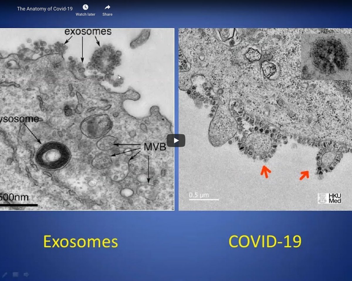 Supverse's tweet photo. https://t.co/5XEk827kOj The Anatomy of Covid-19 - YouTube... https://t.co/vijKWcotQJ
