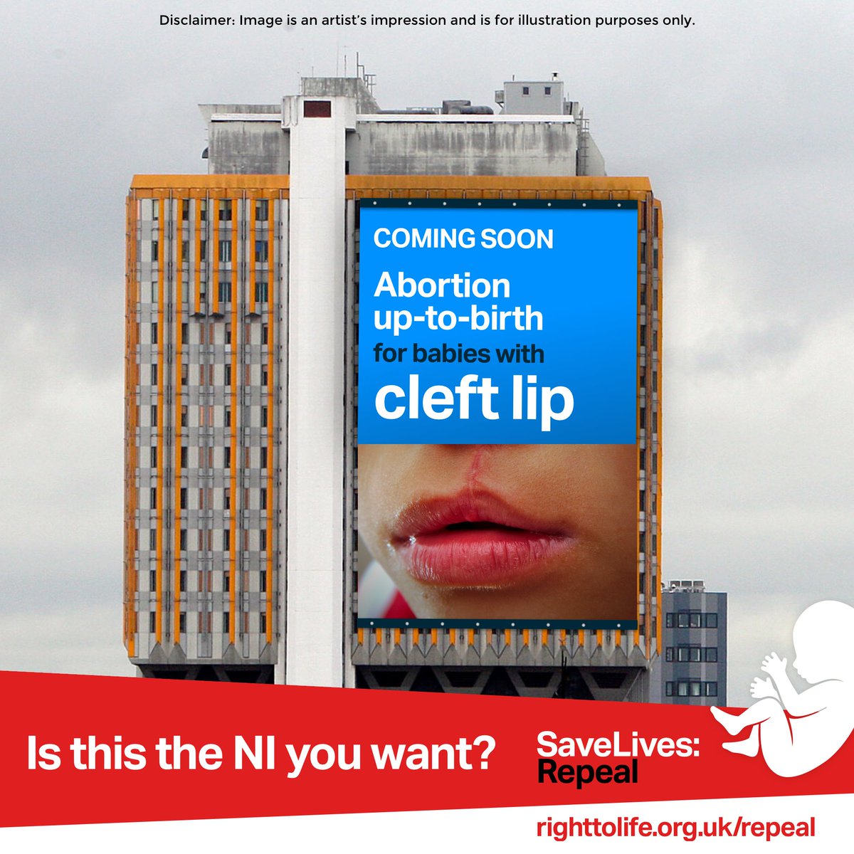 RightToLifeUK's tweet photo. Abortion up to birth for babies with cleft lip... 😨
Is this the NI you want? 

Save lives! Tell your MLAs to repeal the extreme abortion law set to be imposed next week. #SaveLivesRepeal https://t.co/LZUrIeegnA