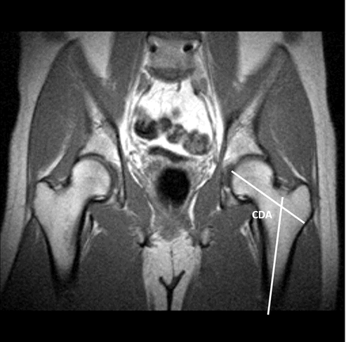 BJR_Radiology's tweet photo. Anatomical analysis of the pelvis to identify any predisposing anatomical factors for ischiofemoral space pathology: a retrospective study
https://t.co/3j5ZEJkH5n
#radiology https://t.co/YTzKexDdEK