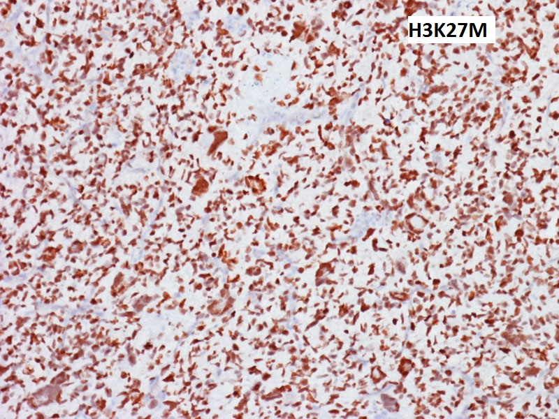 Brain Pathology tweet media