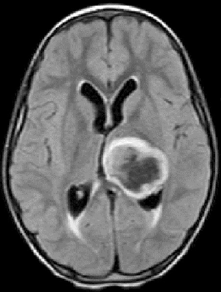 Brain Pathology tweet media