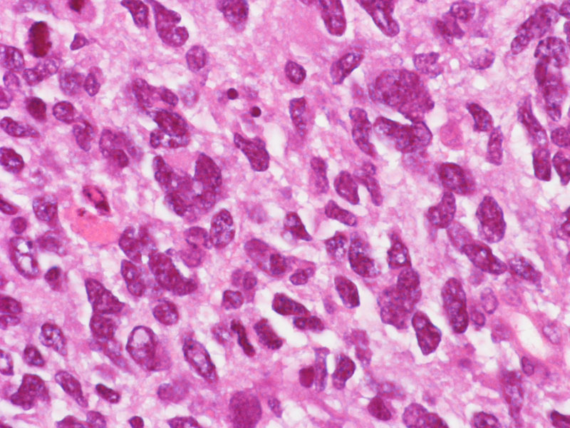Brain Pathology tweet media