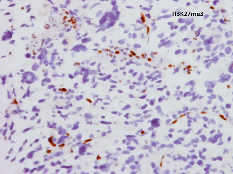 Brain Pathology tweet media