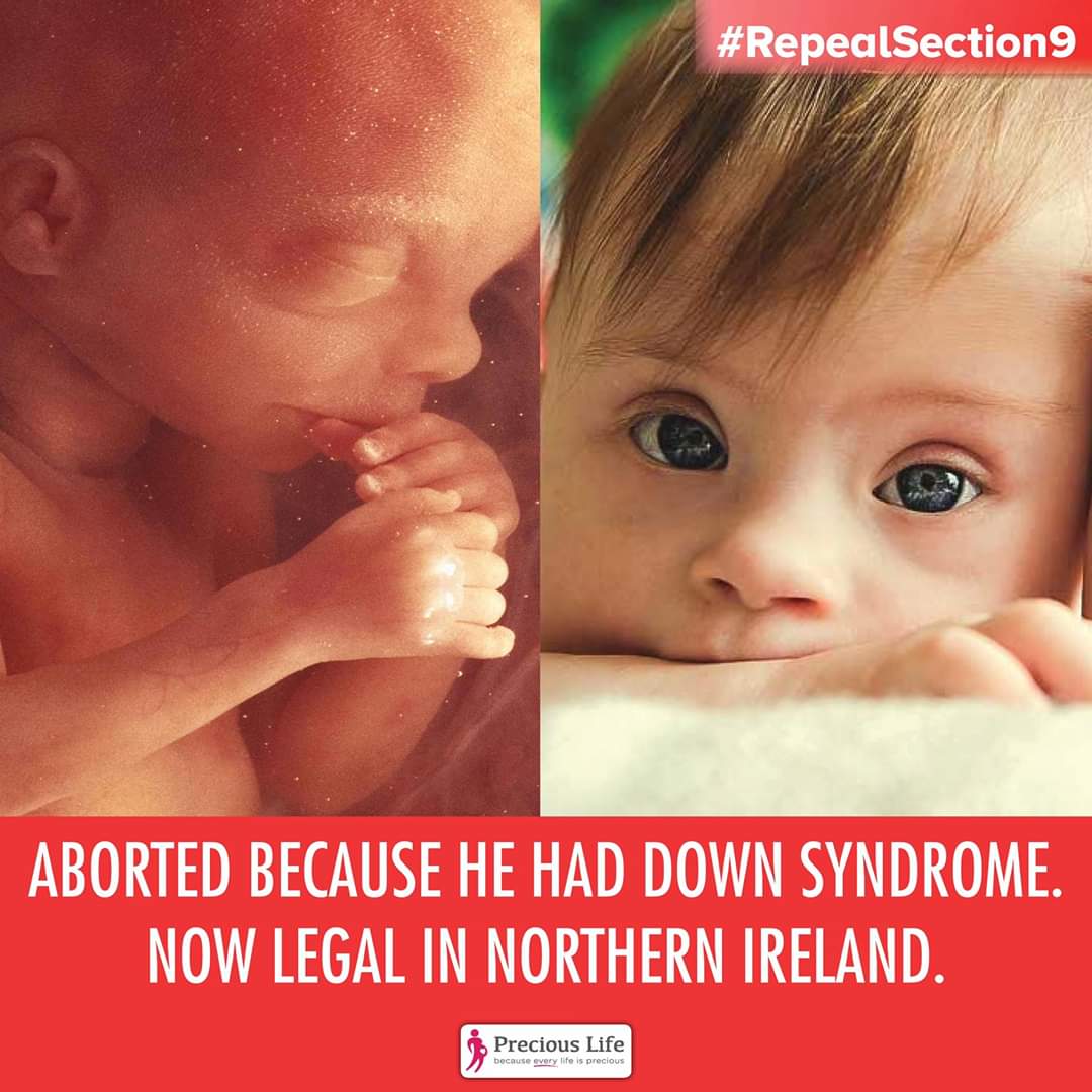 RockofLifeNI's tweet photo. Aborted because he had #DownSyndrome
Now legal in Northern Ireland 31/3/2020 ⚠️UP TO THE POINT OF BIRTH!
Read more..👇
https://t.co/wTj8wbhERW
#RepealSection9 #WeAreThe79PerCent
#DontScreenusOut #DownRightDiscrimination #ImWithHeidi #imwithHector https://t.co/SkleffBzZX