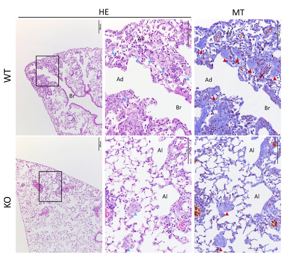 Using TMPRSS2-knock out (KO) mice the investigators showed a weakened inflammatory chemokine and/or cytokine response. Lung inflammatory reactions were less pronounced in the KO mice. Granulation tissue (Masson bodies, shown by arrows) https://doi.org/10.1128/JVI.01815-18 #COVID1912/x