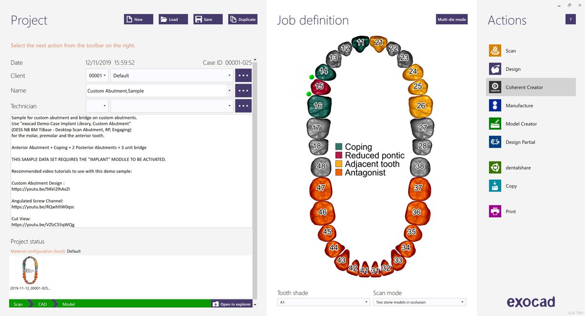 CoherentLaser's tweet photo. We are pleased to announce our collaboration with the CAD/CAM software developer #exocad! Learn more about the integration between exocad’s DentalDB software and the Coherent CREATOR Dental Cockpit software. https://t.co/jzpDpNLI2c #CoherentInc #DigitalDentisty #3DMetalPrinter https://t.co/rYS4VZ7HZh