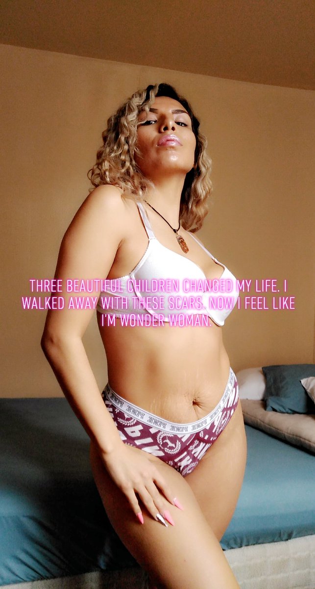 My Children Changed My Life forever. I walked away with these scars. Once I was ashamed of the Scars. Now I love who they made me Become. #FantaciaLopez #singer #momlife