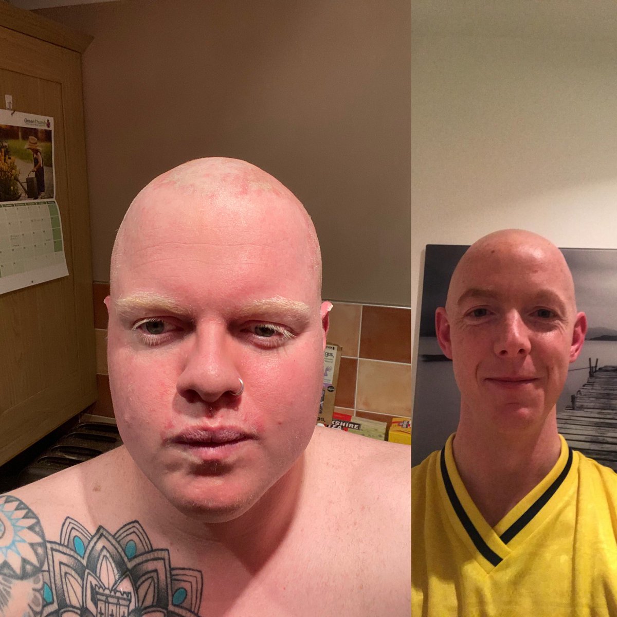@RealMattLucas me and my best mate shaved our heads for the NHS and have raised over 2k in a day!! any chance of a retweet to try and raise some more for those absolute hero’s 
JustGiving.com/crowdfunding/A…

#bakedpotatoes #NHS #charity