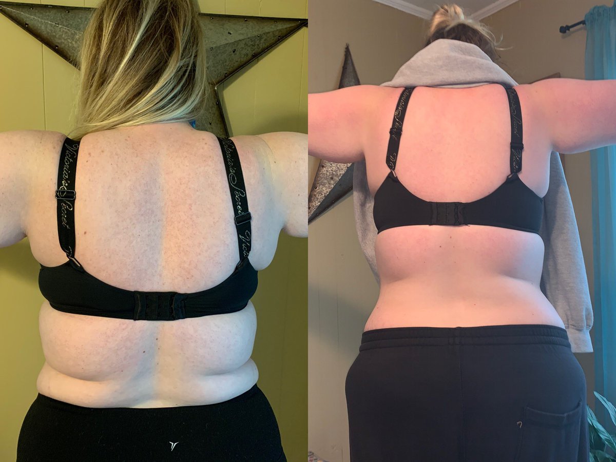 haleyhouse44's tweet photo. Just down 25 pounds and 10.5 inches. No big deal 🤪🤩 https://t.co/XWfjjCvam6