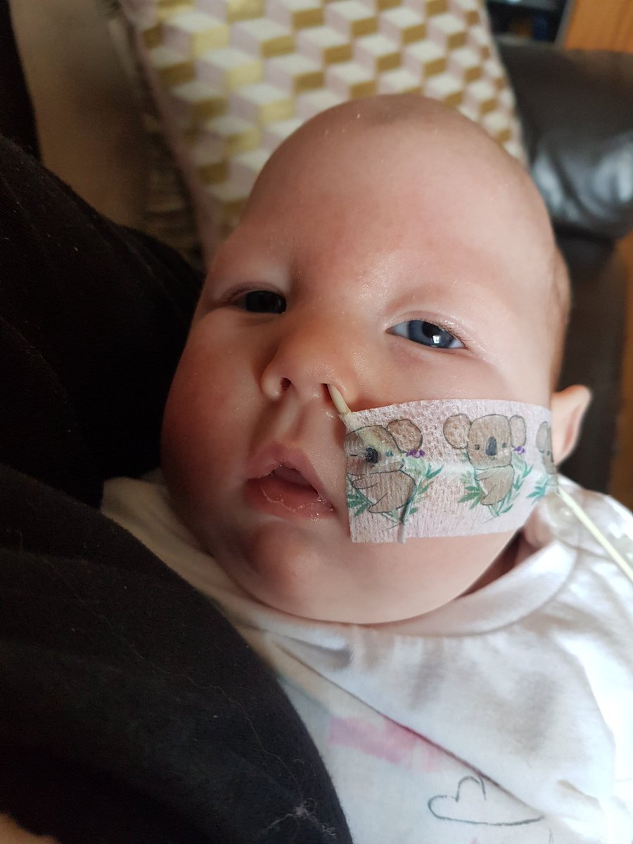 JenniferDicks6's tweet photo. Tomorrow is the first day of HIE awareness month. Until November, I had never heard of HIE, now it is all I think about. Hypoxic ischemic encephalopathy is when the brain is deprived of oxygen. This is what Charlotte suffered and the reason she has additional needs. #hie https://t.co/rwZWyBnvxx