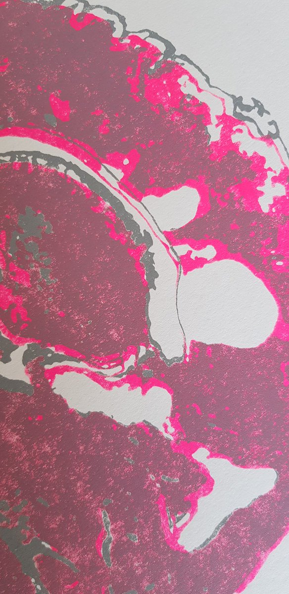 charcotstudio's tweet image. I am continuing to develop this new way of working on lock down &amp;amp; I am excited to share the new Digital Gift Cards now available@ CHARCOT.CO.UK 🧠💕 #charcotstudio #makingMSvisible #redesigning #MRIscans #innovative #MSawareness #MS #stopMS #newways #COVID19 #lockdownUK