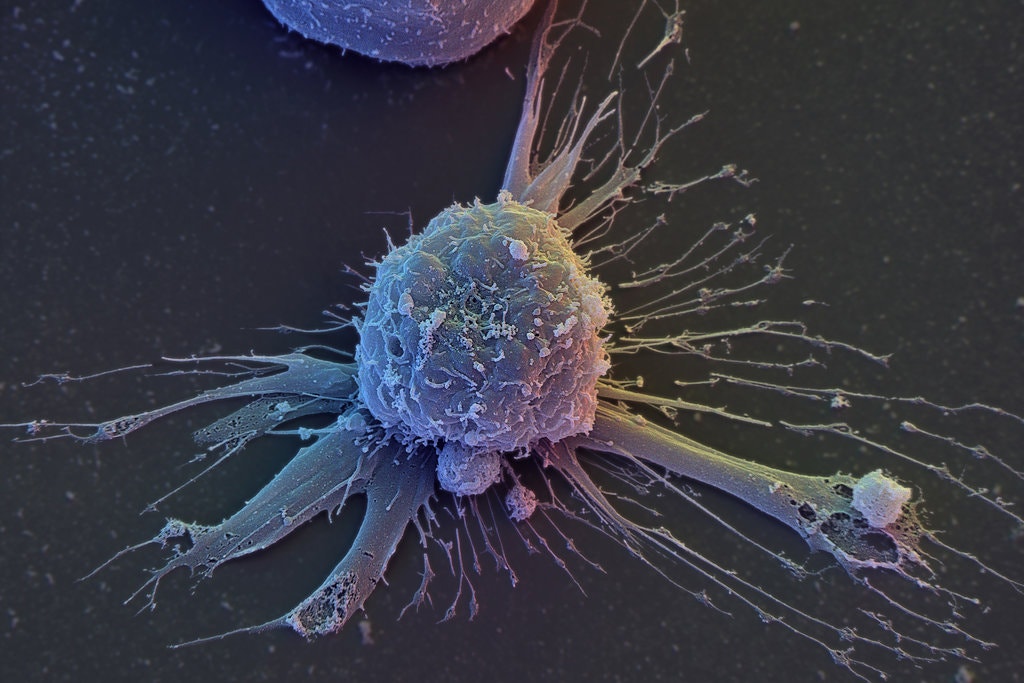 CaraSantaMaria's tweet photo. Researchers report that they can rejuvenate human cells by reprogramming them to a youthful state. Whoa.
#StemCells #Aging #HumanCells #CellState #CellProgramming
https://t.co/6z7N9xUS2H https://t.co/64n2QTw1YF